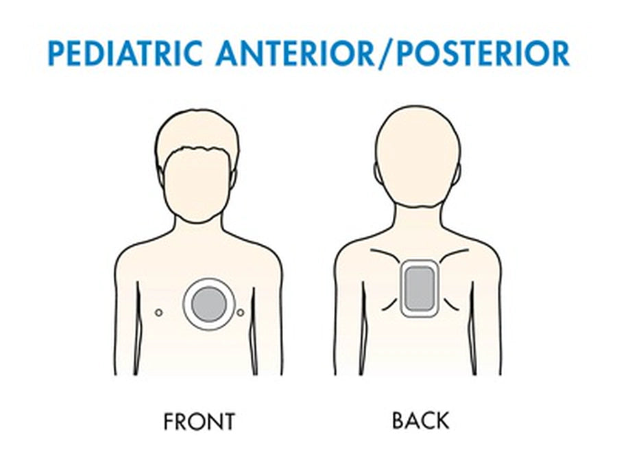 How to Use an AED on Infants and Children: A Complete Safety Guide - Image 2