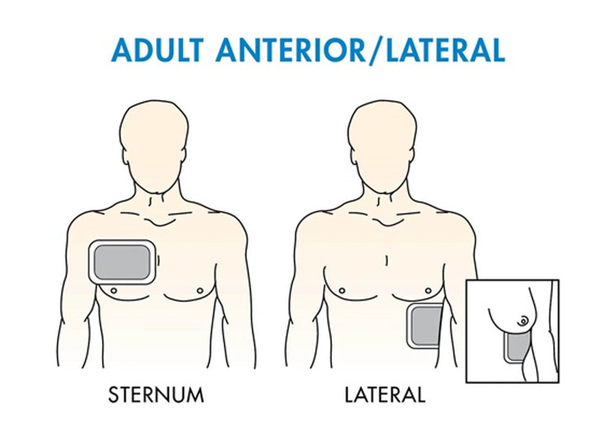 How to Use an AED on Infants and Children: A Complete Safety Guide - Image 3