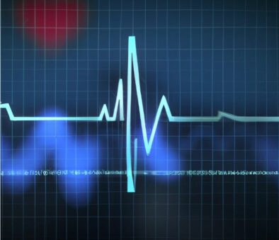 Asystole vs V-FIB